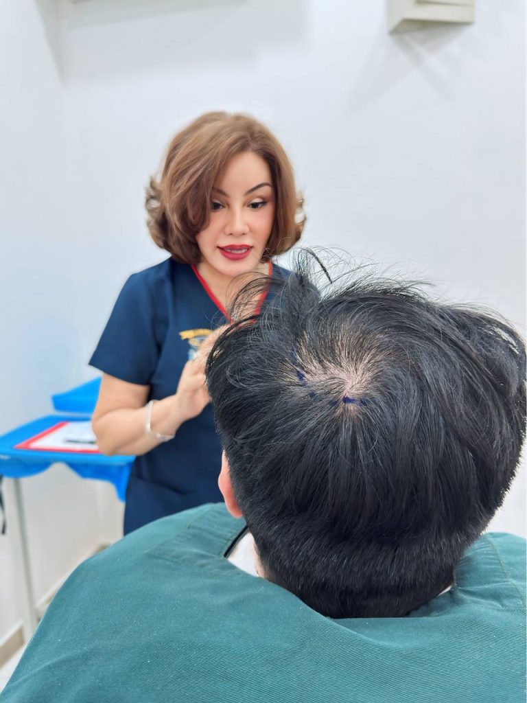 Crown Hair Transplant Marking