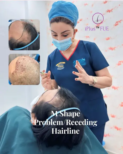 m-shap hair transplant Observation Dr Inder