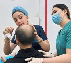 Hair Transplant Treatment/Surgery